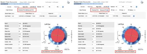 orba toric|Calculator .